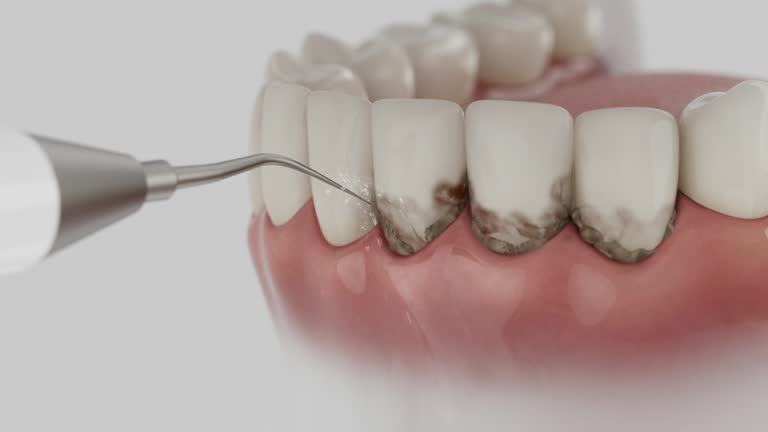 Reliable Invisalign Clear Aligners contractor in Hot Springs County County, WY by Dentist Open Now